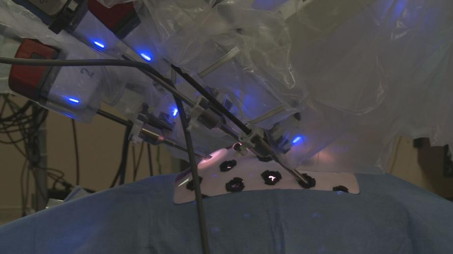 Robotic tech at Jewish Hospital