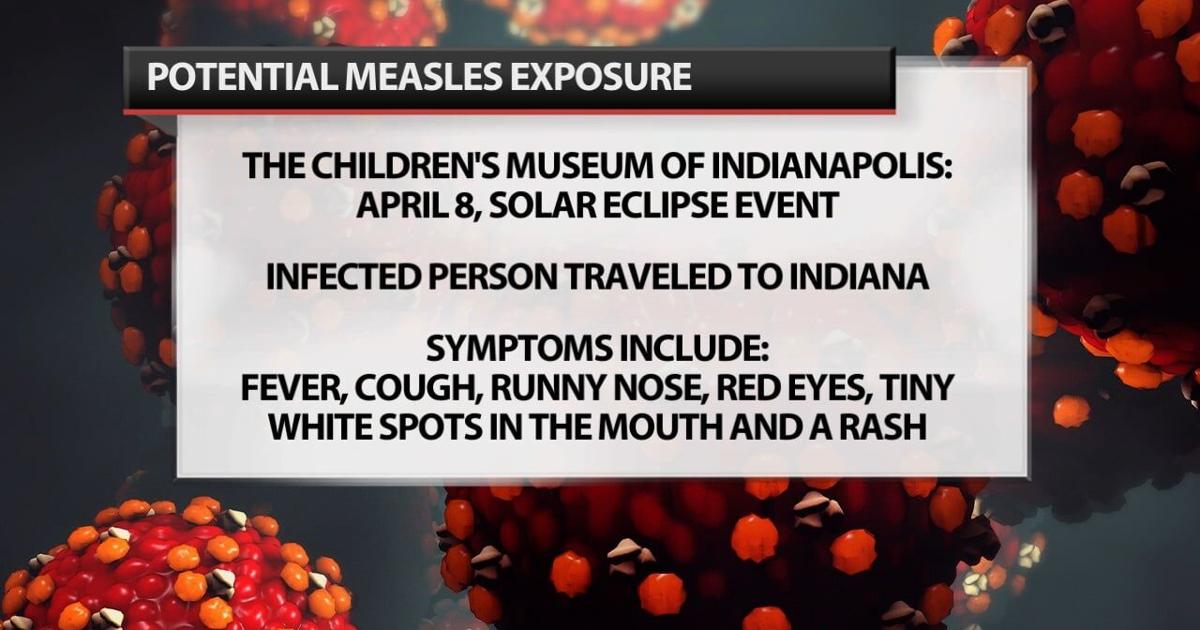 Health department warns visitors of Indianapolis children’s museum of potential...
