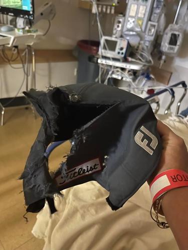 Hat damaged by lightning strike at Meadowbrook Golf Course in Lexington