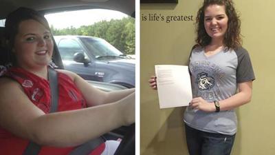 OBESE YOUTH - Faith Newsome Before and After Bypass Surgery
