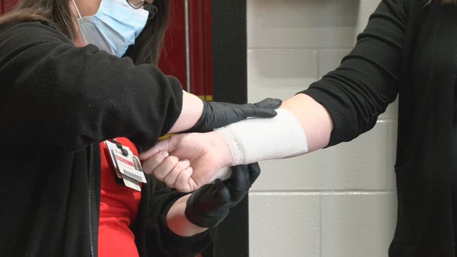 BURN AWARENESS - UOFL HEALTH - 2-7-2022  (3).jpeg