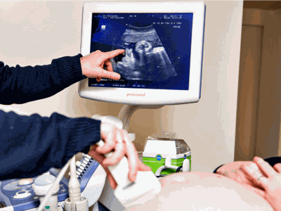 Ultrasound pregnancy generic