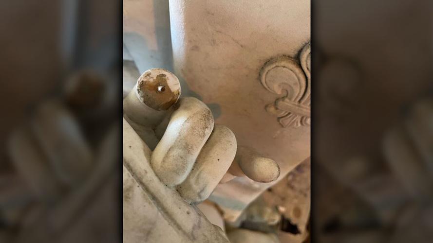 KING LOUIS MISSING FINGER.png