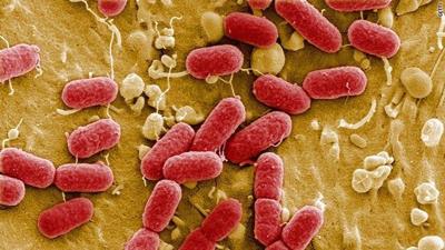 Bacteria sickens more than 500 at Gatlinburg zipline attraction