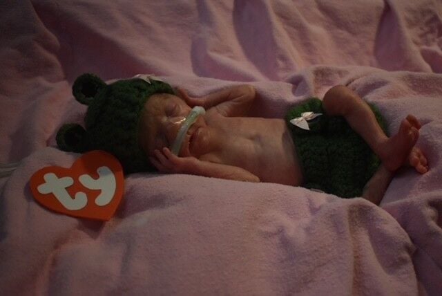 UofL Hospital NICU babies