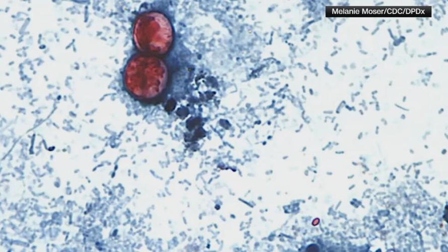 Cyclospora