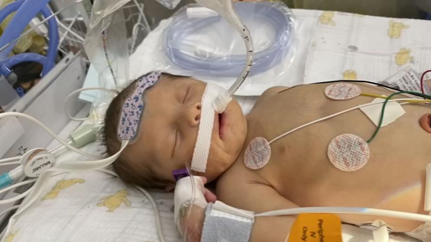 SHIRLEYS WAY HELPS HEART DISEASE BABY