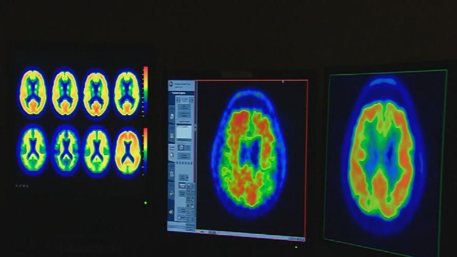 Brain Scans file photo 2