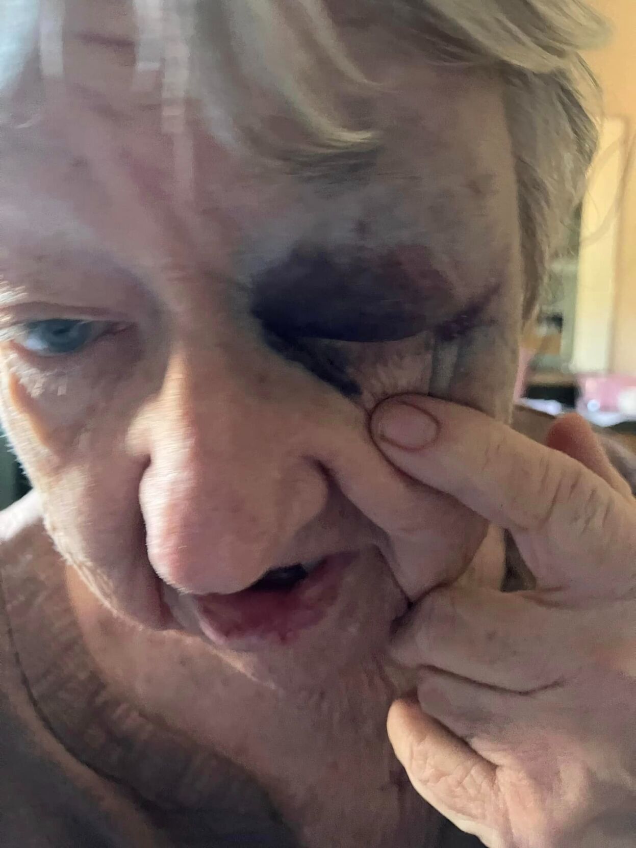 Alleged abuse at Indian Creek Healthcare Center 2.jpg