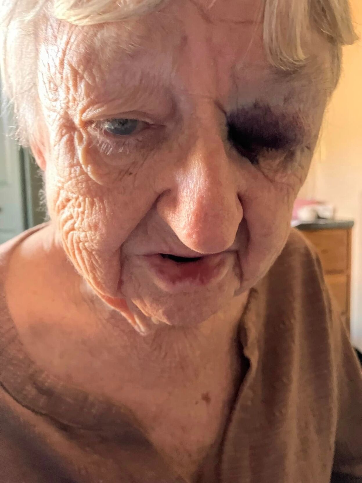 Alleged abuse at Indian Creek Healthcare Center.jpg