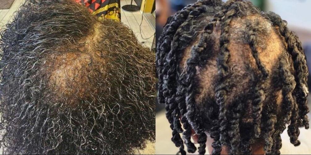 Ira Porter - Before and After hair.jpg