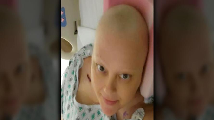Tracy Bandy without hair after chemo treatments