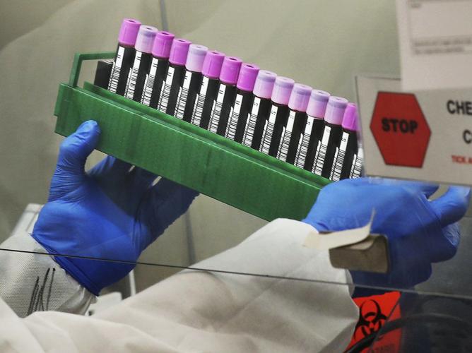 VIRUS - MAYO CLINIC RESEARCH - AP 4-28-2020 5.jpeg