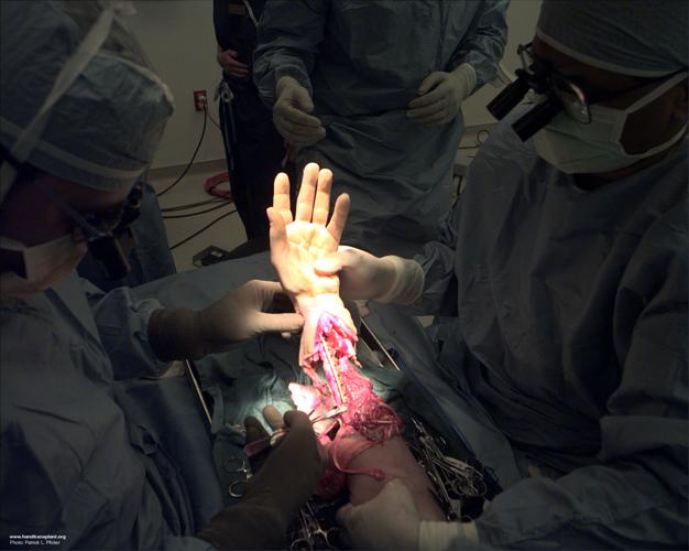 MATTHEW SCOTT - HAND SURGERY 1999 1 - COURTESY.jpg