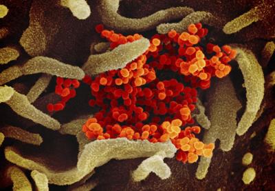 COVID -19 VIRUS GENERIC.jpeg