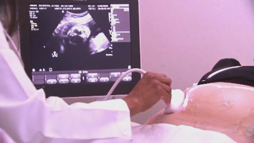 ABORTION - SONOGRAM - ULTRASOUND.jpg