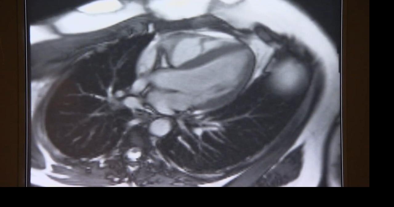 What is Commotio cordis?