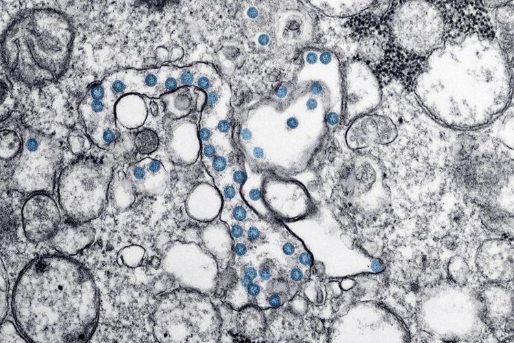 COVID-19 cells under microscope