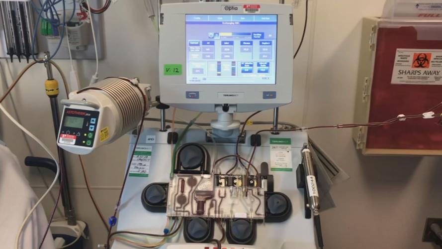 Norton Healthcare seeking plasma donations from recovered COVID-19 patients that may treat the critically ill