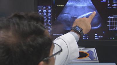 Doctor shows ultrasound