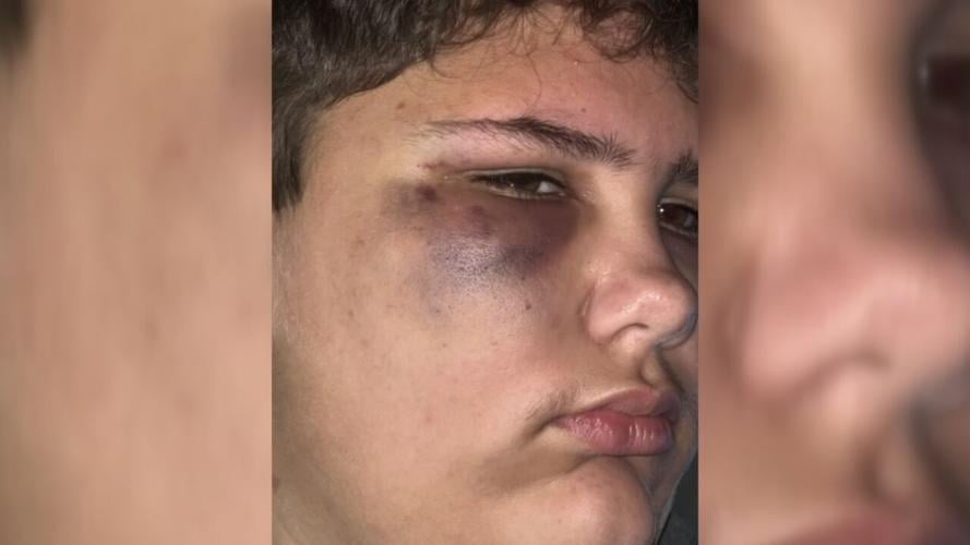 JCPS BUS BULLYING INJURIES