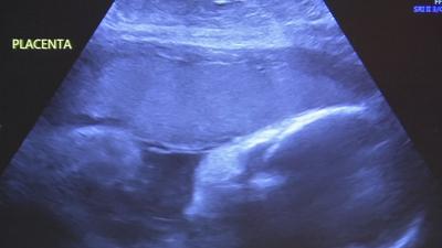 Black Maternal Health Week