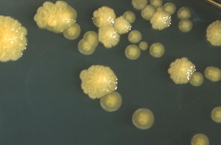 Infant Formula Bacteria
