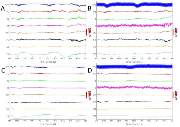 EEG OF DYING HUMAN BRAIN 2 - COURTESY.jpg