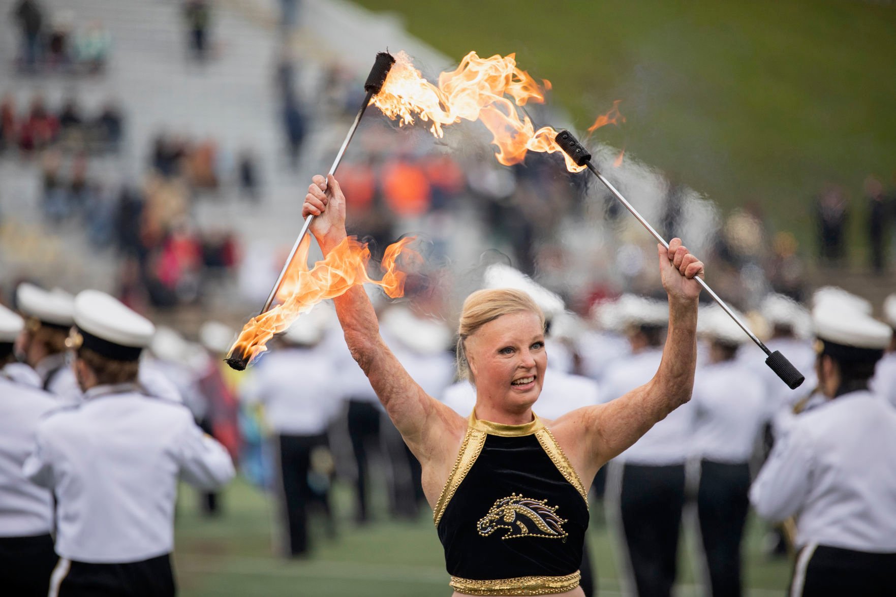 Fighting the flames WMU burn survivor talks twirling nursing