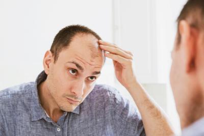 Balding young man