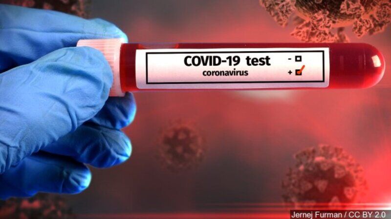 Over 300 New Positive COVID-19 Cases Identified in Western Kentucky