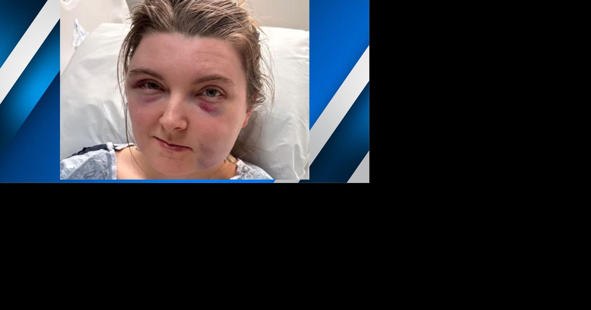 Community rallies for deputy jailer after inmate assault incident in Western Kentucky