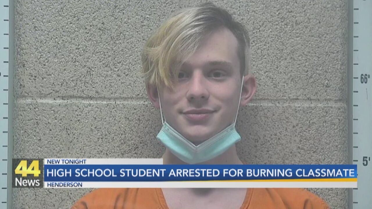 18-Year-Old Charged After Henderson County High School Student Burned in Shop Class News wevv