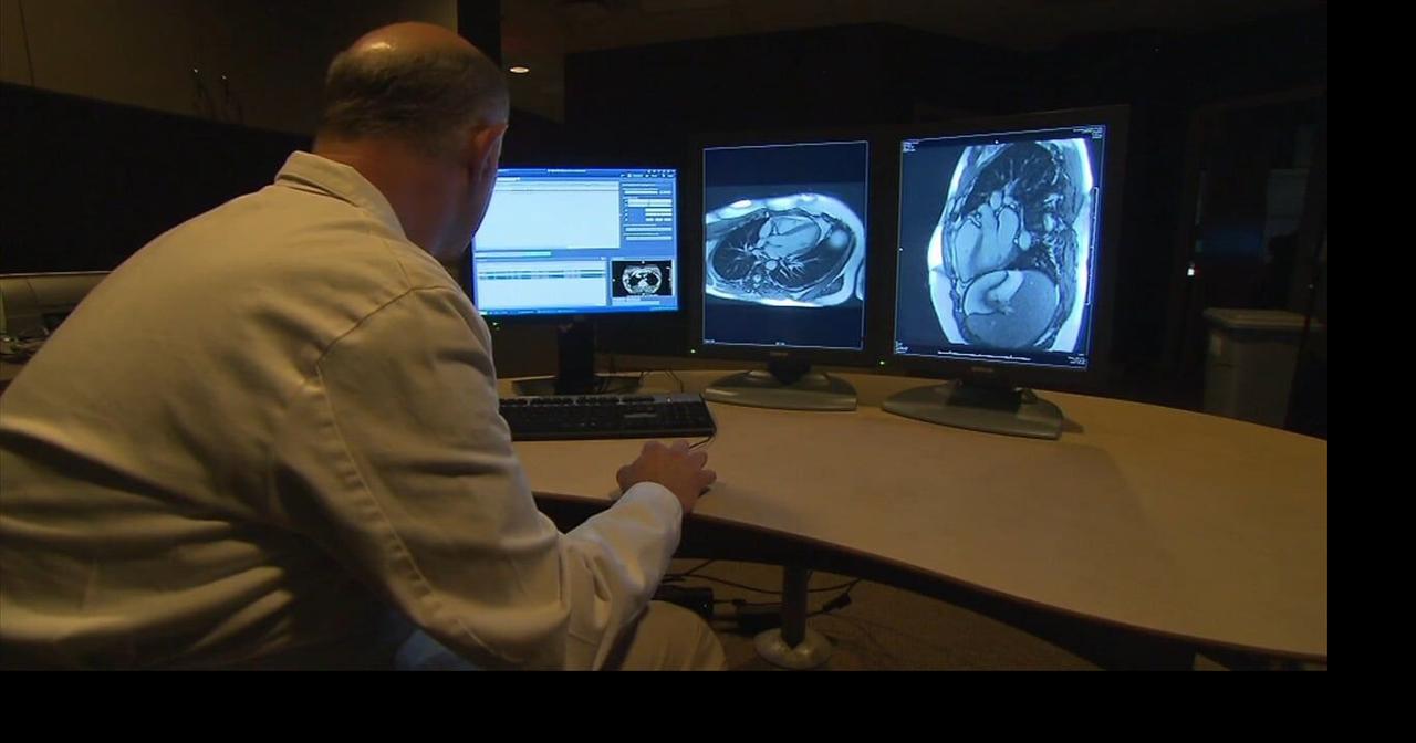 Health Beat: Heart attacks and cognitive impairment