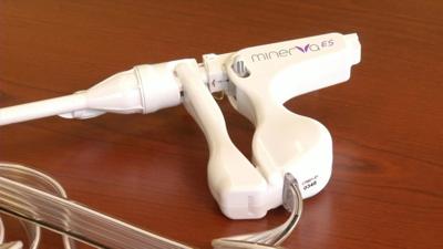 Health Beat Minerva Ablation To Stop Aunt Flo Health Wfmz Com