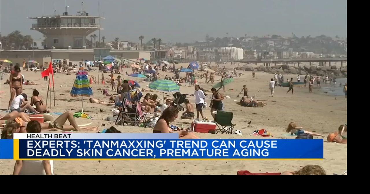 Health Beat: Social media trend may be partly to blame for the rise in skin cancer