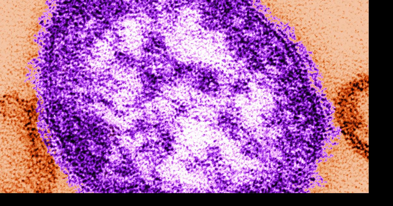 Possible measles exposure reported at Phila. International Airport | Southeastern Pennsylvania