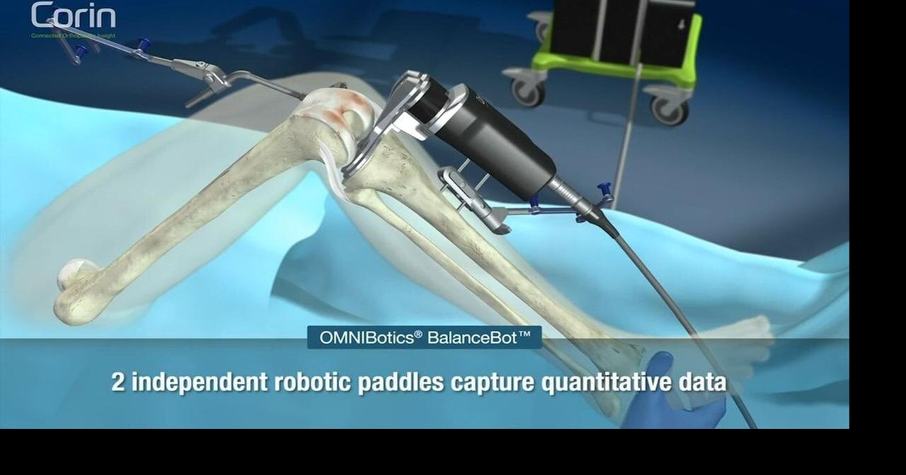 Health Beat: BalanceBot: More precise total knee replacements | Health ...