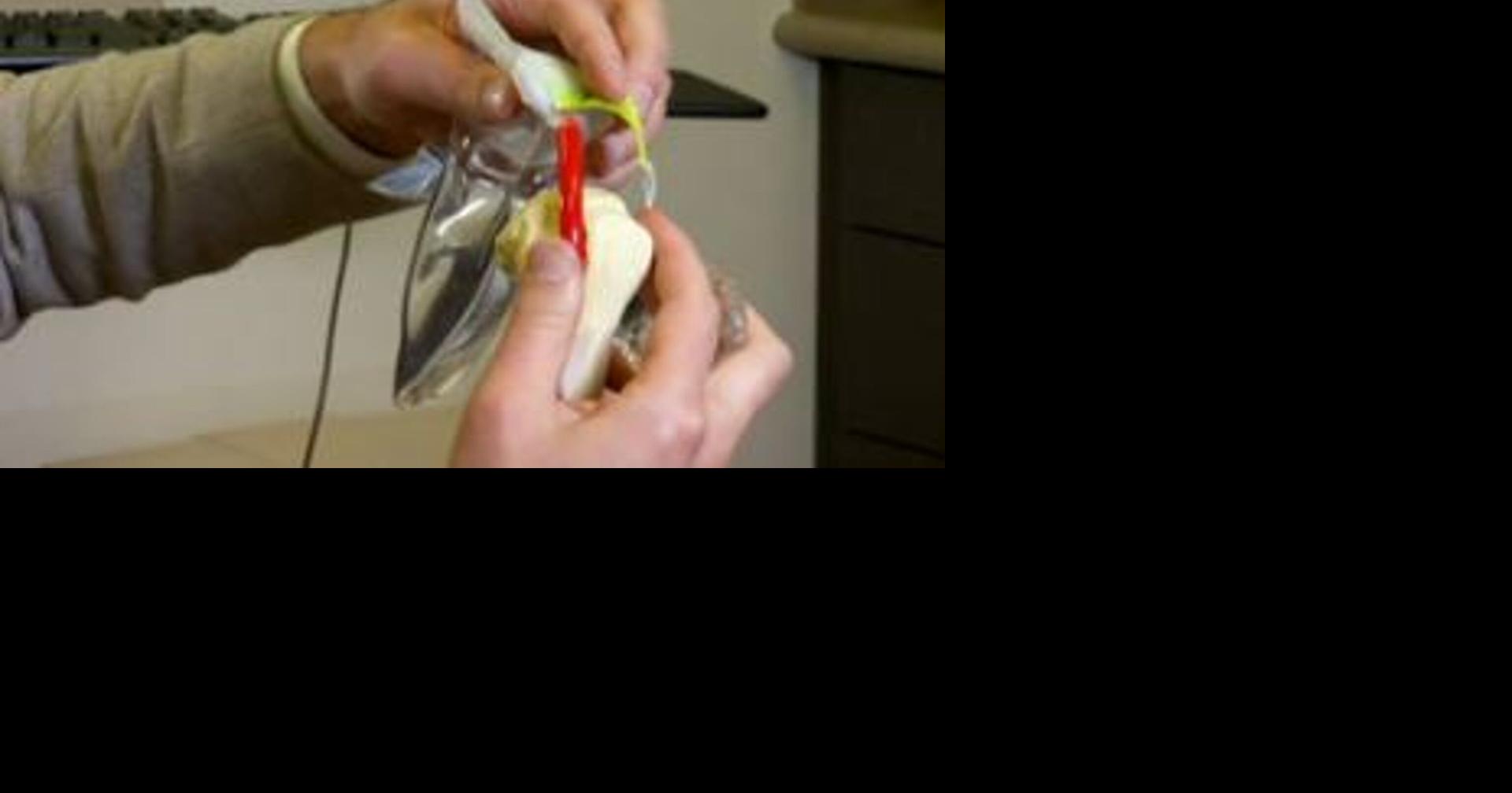 Health Beat: Balloon spacers for rotator cuffs | Health Beat | wfmz.com