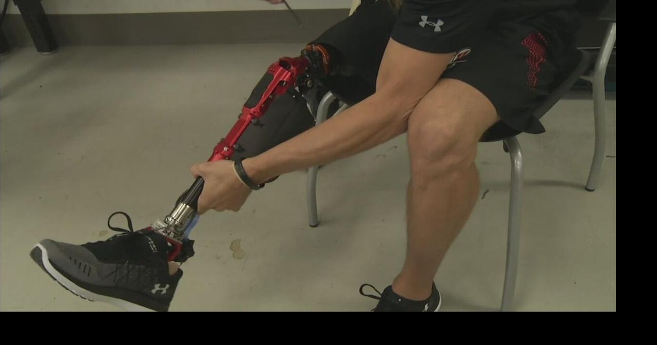 Health Beat: World's first truly bionic leg | Health Beat | wfmz.com