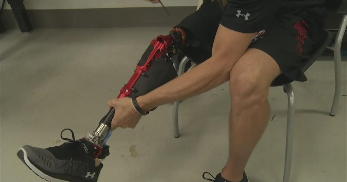 Bionic Legss Health Beat: World's first truly bionic leg | Health Beat | wfmz.com