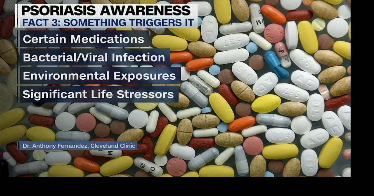 Health Beat: 5 facts about psoriasis from the Cleveland Clinic