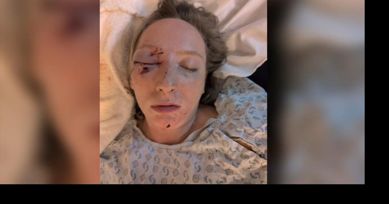 Another driver severely injured by flying ice on Pennsylvania highway