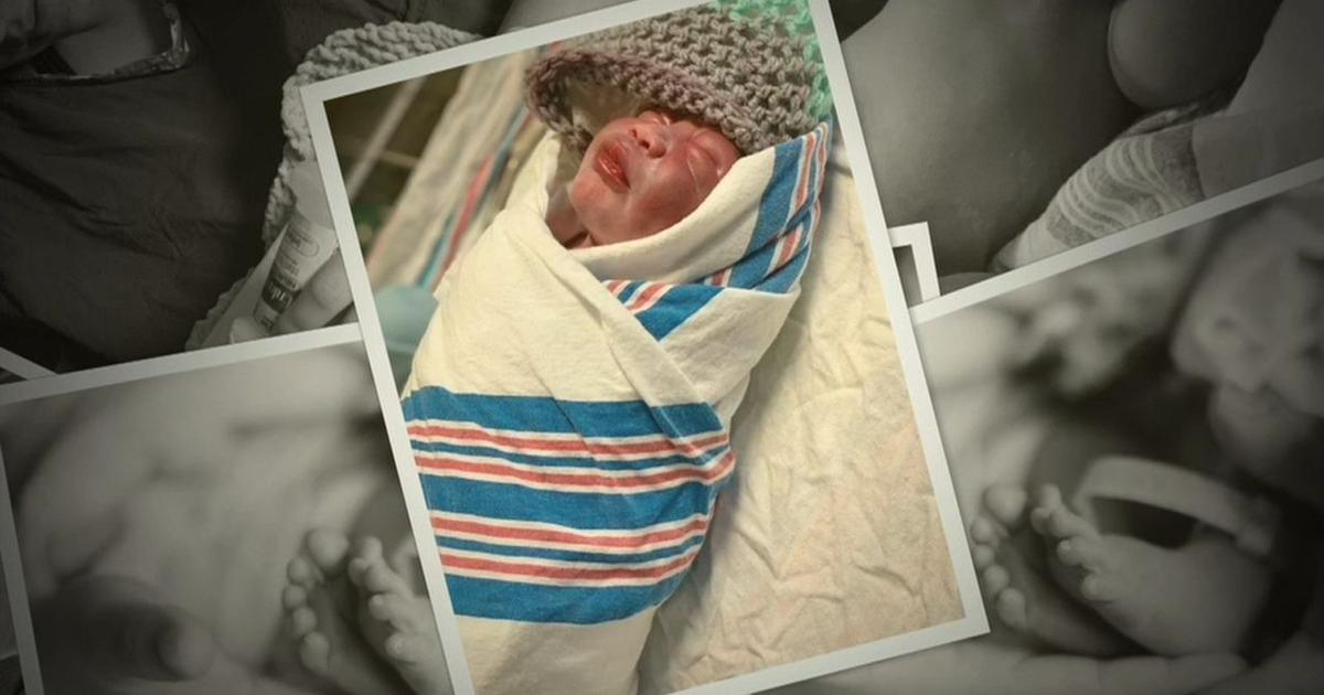 Exencephaly Health Beat: Baby survives exencephaly | Health Beat | wfmz.com