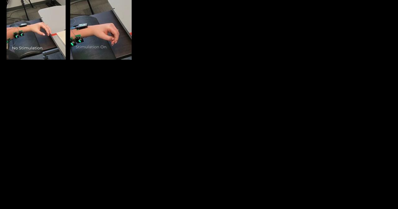 Health Beat: Neurotechnology instantly helps stroke patients move - Vimarsana News