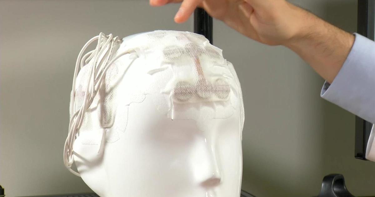 Health Beat: Battling brain tumors with Optune | Health | wfmz.com