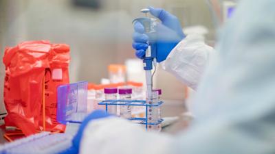 Number Of Coronavirus Cases In Pennsylvania Now At 45 Health
