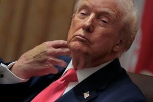 Trump blames bruised hand on aspirin, denies falling asleep