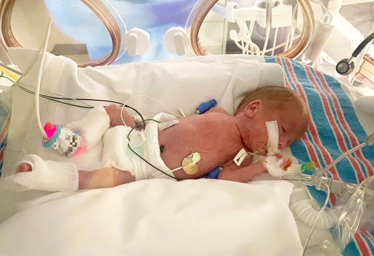 Premature Baby Born at 25 Weeks and Weighing Less Than a Loaf of Bread is Thriving Now
