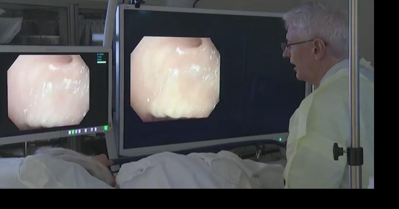 AI technology can improve colonoscopies | Health | wfmz.com